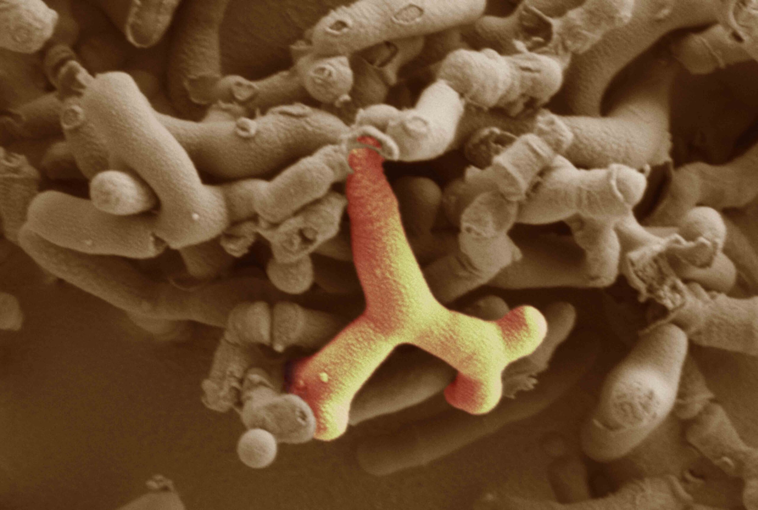 A highly magnified microscopic image showing a cluster of cylindrical, fungus-like structures in beige, with one structure highlighted in yellow and red. The surface appears textured and organic.