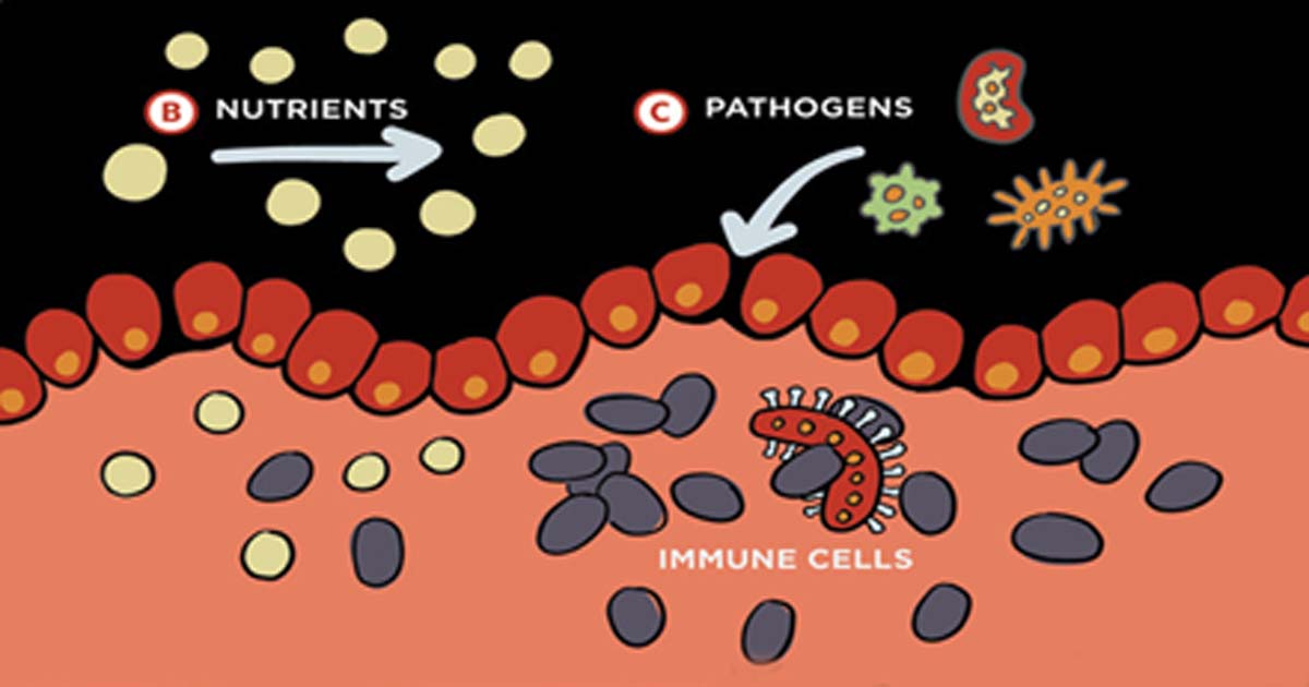 Environmental enteric dysfunction: illustration of leaky gut