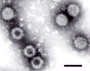 A grayscale microscopic image showing several spherical virus particles with spiky outer edges. The background is light gray, and the particles are clustered in groups. A scale bar is present at the bottom right corner.